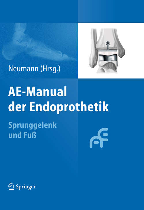 Book cover of AE-Manual der Endoprothetik: Sprunggelenk und Fuß