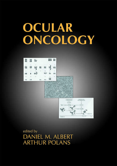 Book cover of Ocular Oncology (1)