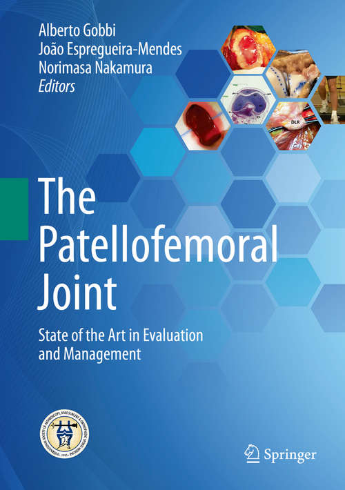 Book cover of The Patellofemoral Joint