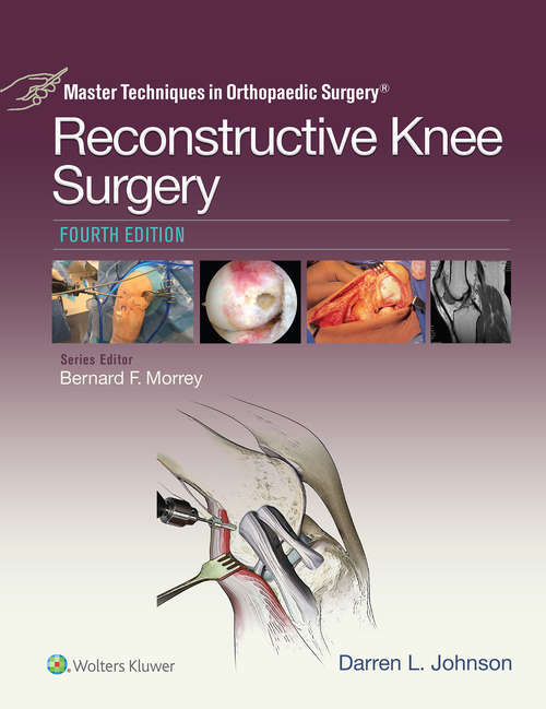 Book cover of Master Techniques in Orthopaedic Surgery: Reconstructive Knee Surgery (4) (Master Techniques in Orthopaedic Surgery)