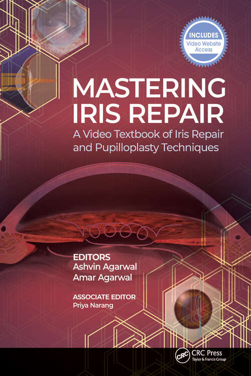 Book cover of Mastering Iris Repair: A Video Textbook of Iris Repair and Pupilloplasty Techniques