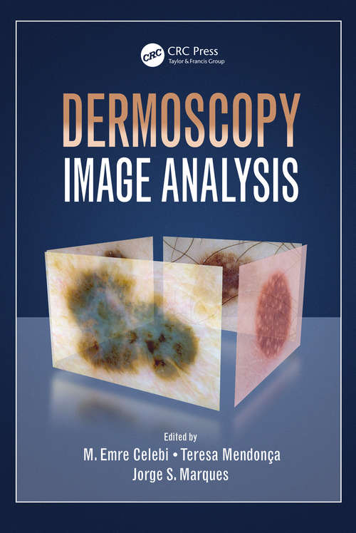 Book cover of Dermoscopy Image Analysis (Digital Imaging and Computer Vision)