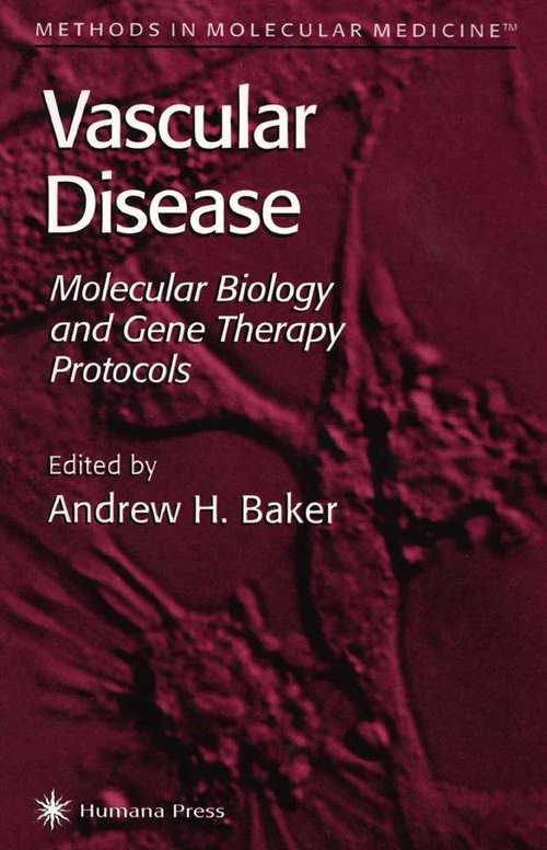 Book cover of Vascular Disease