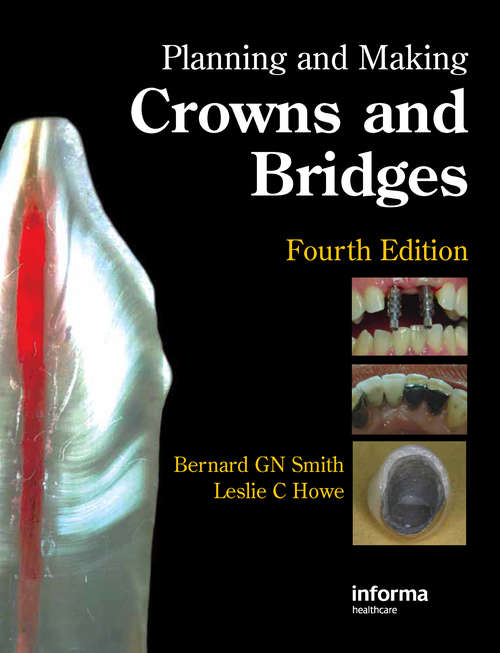 Book cover of Planning and Making Crowns and Bridges