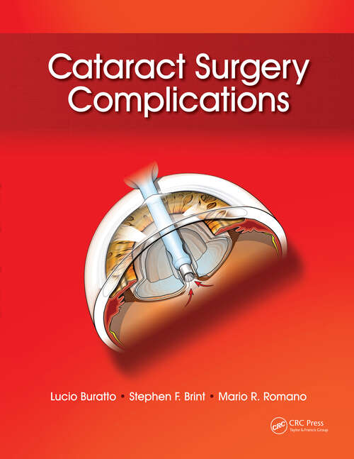 Book cover of Cataract Surgery Complications