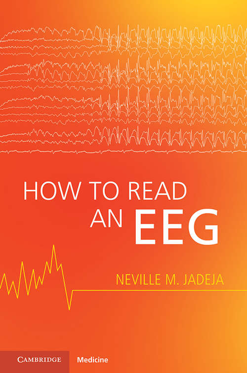 Book cover of How to Read an EEG