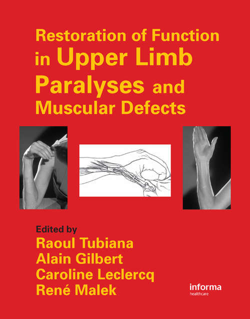 Book cover of Restoration of Function in Upper Limb Paralyses and Muscular Defects