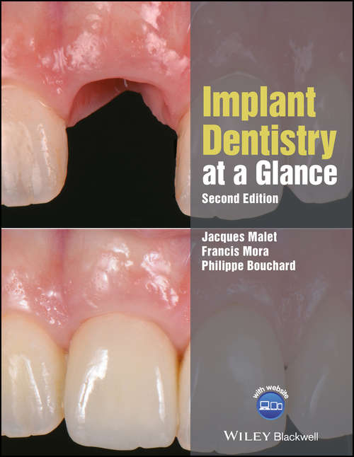 Book cover of Implant Dentistry at a Glance (At a Glance (Dentistry) #60)