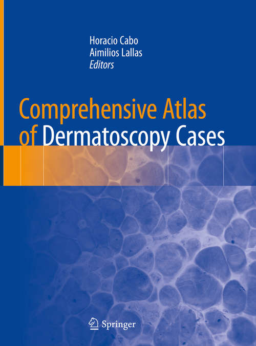 Book cover of Comprehensive Atlas of Dermatoscopy Cases