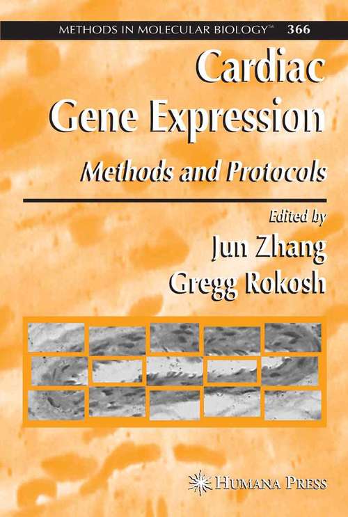 Book cover of Cardiac Gene Expression: Methods and Protocols (Methods in Molecular Biology #366)