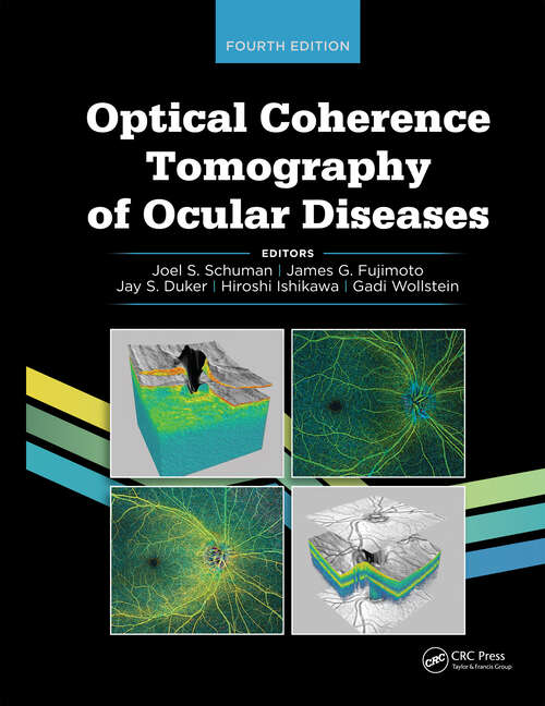Book cover of Optical Coherence Tomography of Ocular Diseases (4)