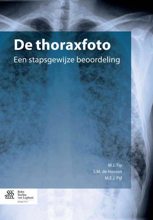 Book cover of De thoraxfoto