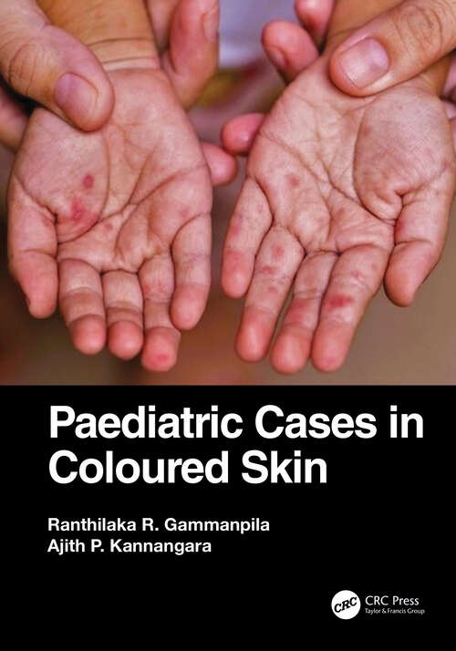 Book cover of Paediatric Cases in Coloured Skin
