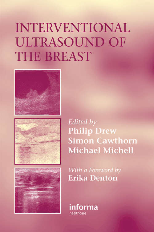 Book cover of Interventional Ultrasound of the Breast