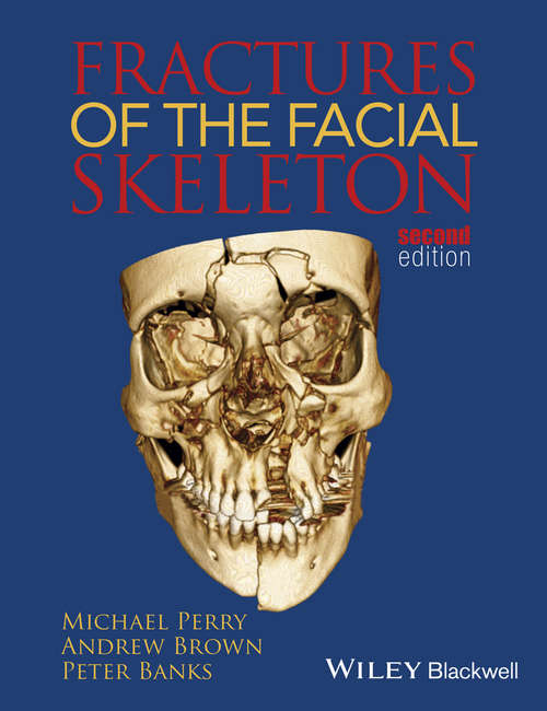 Book cover of Fractures of the Facial Skeleton