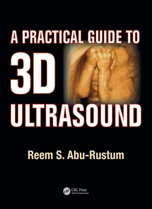 Book cover of A Practical Guide to 3D Ultrasound