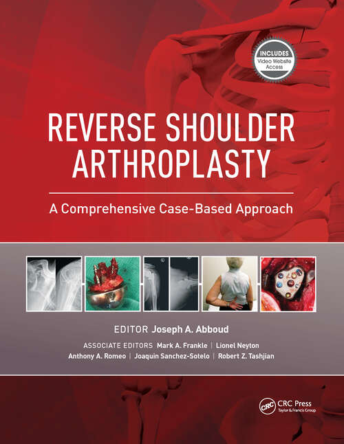 Book cover of Reverse Shoulder Arthroplasty: A Comprehensive Case-Based Approach