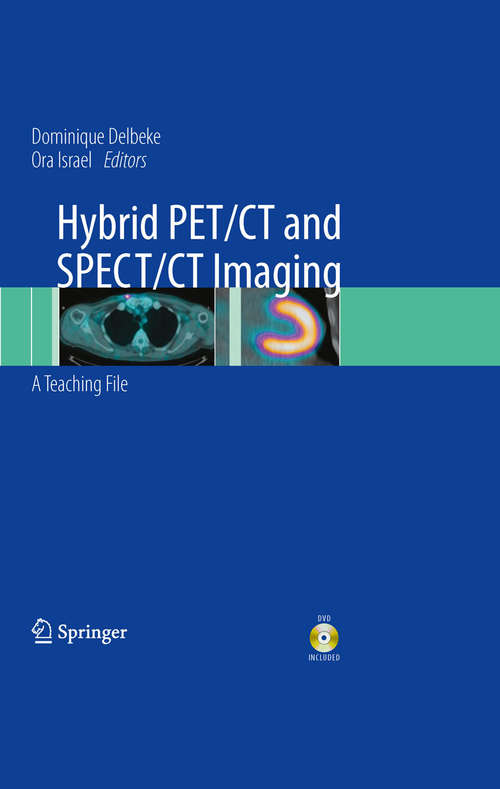 Book cover of Hybrid PET/CT and SPECT/CT Imaging