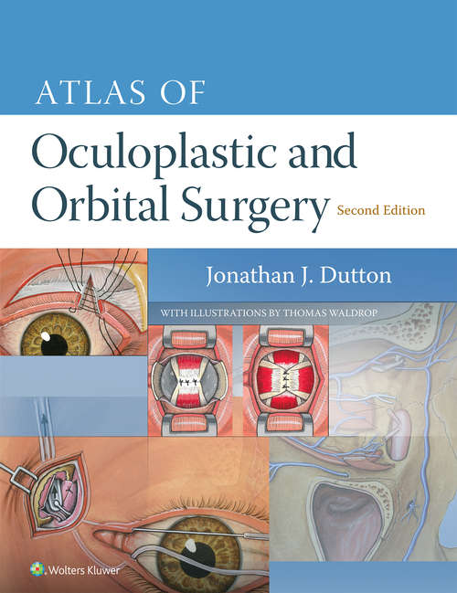 Book cover of Atlas of Oculoplastic and Orbital Surgery (2)