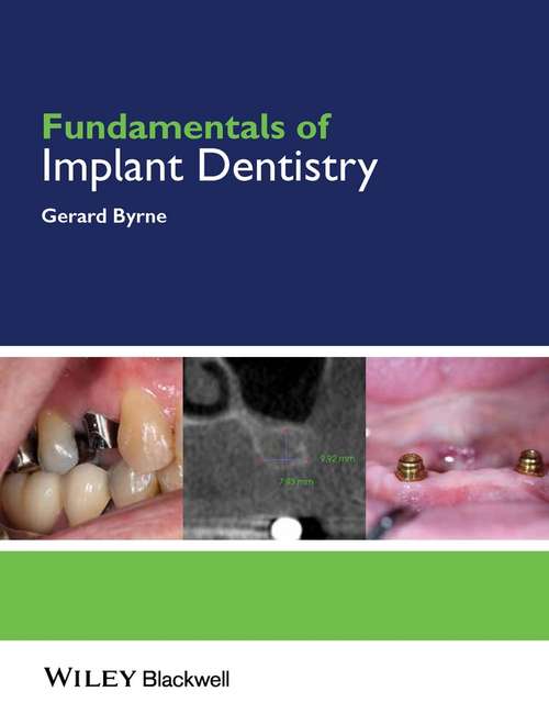 Book cover of Fundamentals of Implant Dentistry