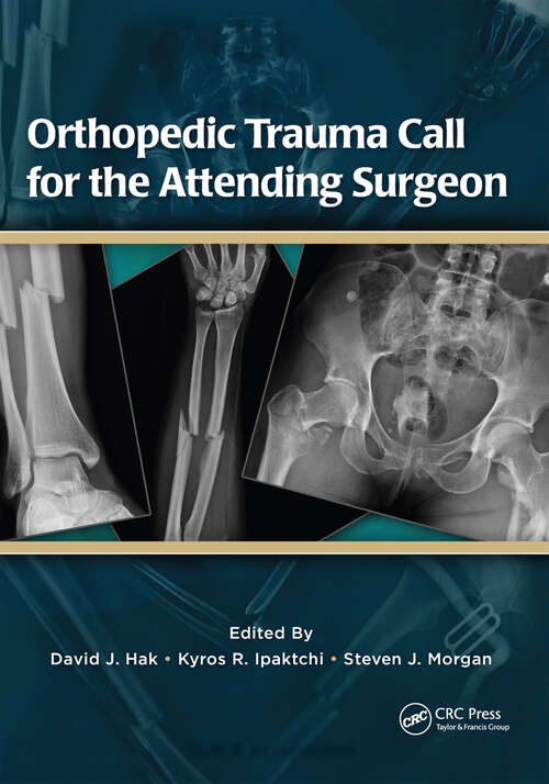 Book cover of Orthopedic Trauma Call for the Attending Surgeon