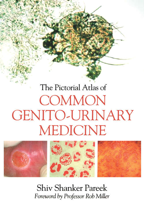 Book cover of The Pictorial Atlas of Common Genito-Urinary Medicine (Radcliffe Ser.)