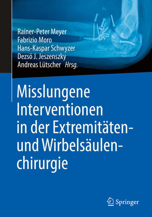 Book cover of Misslungene Interventionen in der Extremitäten- und Wirbelsäulenchirurgie (1. Aufl. 2020)