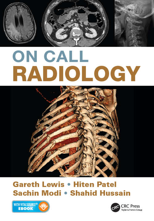 Book cover of On Call Radiology