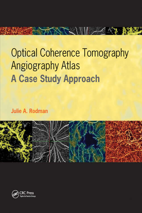 Book cover of Optical Coherence Tomography Angiography Atlas: A Case Study Approach