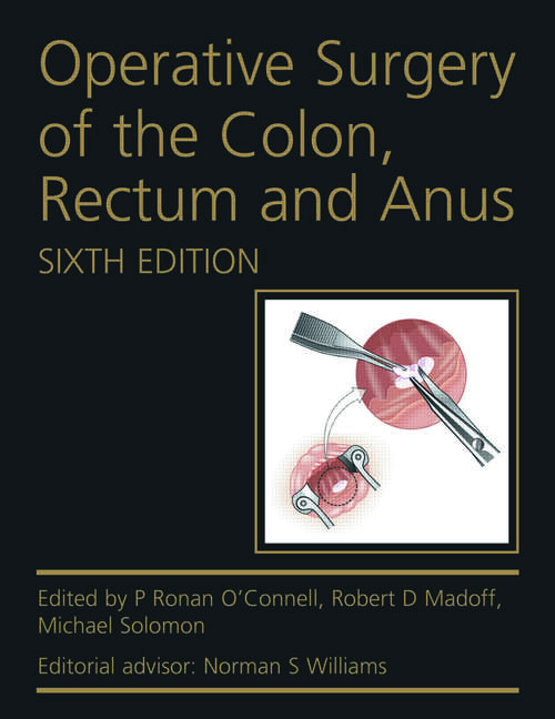 Book cover of Operative Surgery of the Colon, Rectum and Anus