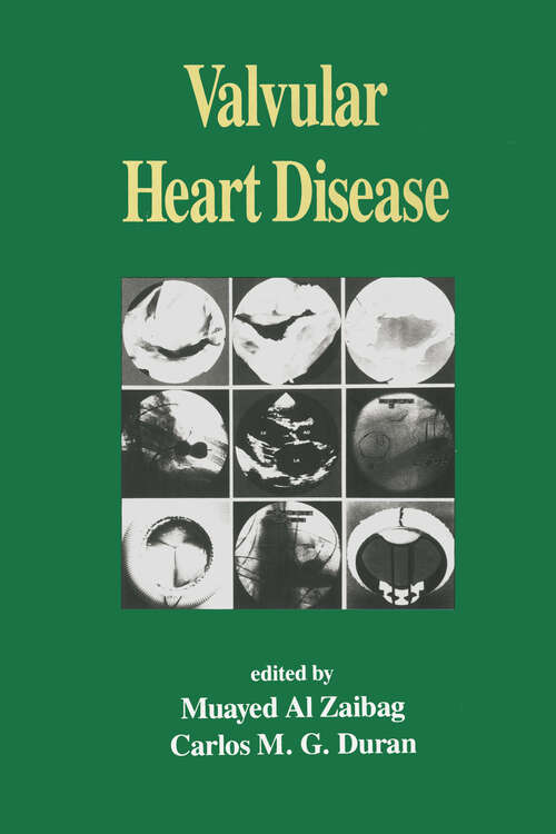 Book cover of Valvular Heart Disease (Fundamental and Clinical Cardiology)