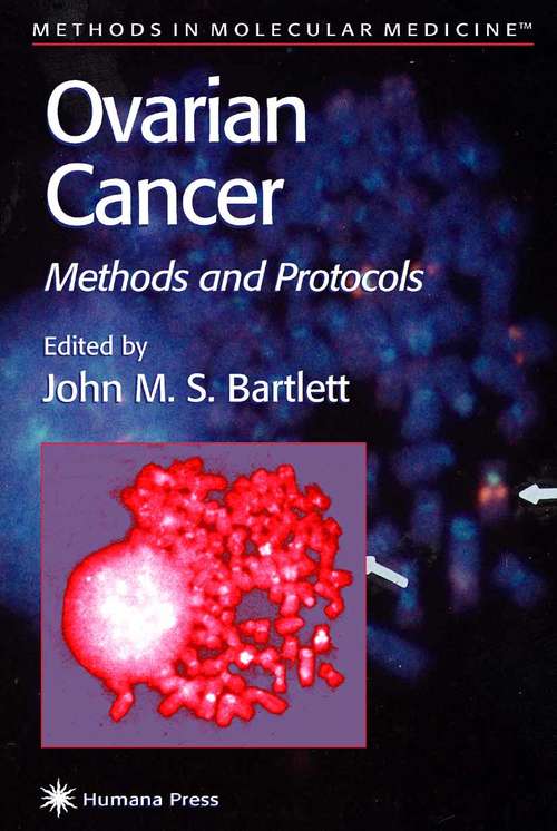 Book cover of Ovarian Cancer