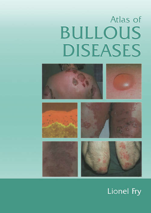 Book cover of Atlas of Bullous Diseases (Routledge Revivals Ser.)