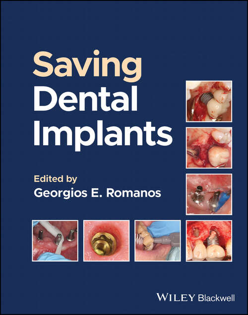 Book cover of Saving Dental Implants