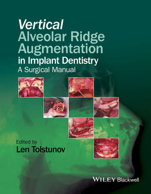 Book cover of Vertical Augmentation of the Alveolar Ridge in Implant Dentistry