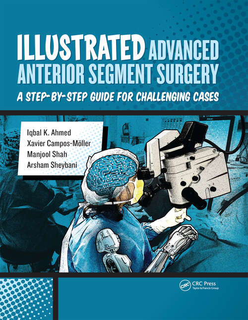 Book cover of Illustrated Advanced Anterior Segment Surgery: A Step-by-Step Guide for Challenging Cases