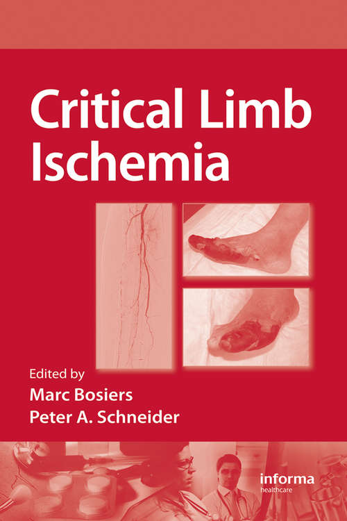 Book cover of Critical Limb Ischemia (1)