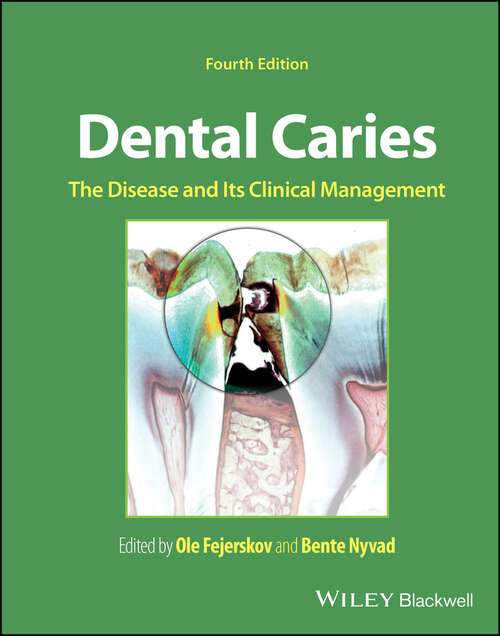 Book cover of Dental Caries: The Disease and its Clinical Management (4)