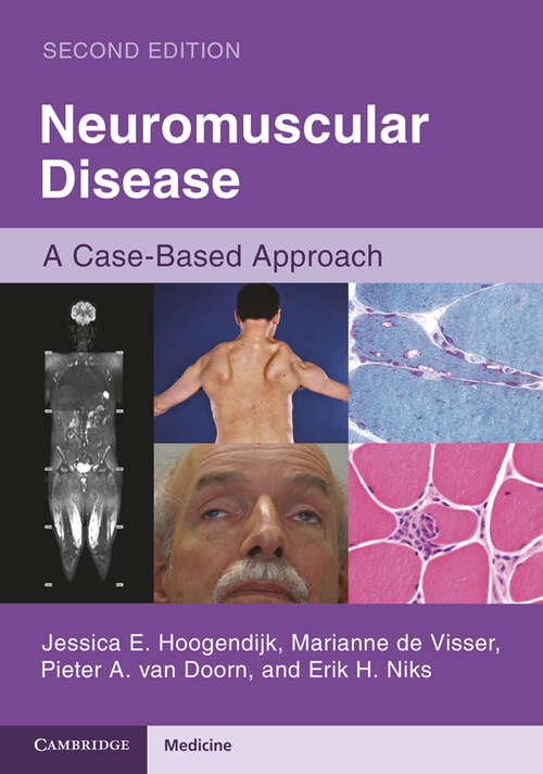 Book cover of Neuromuscular Disease: A Case-Based Approach (2)