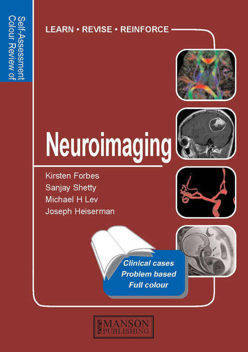 Book cover of Neuroimaging: Self-Assessment Colour Review (Medical Self-Assessment Color Review Series)