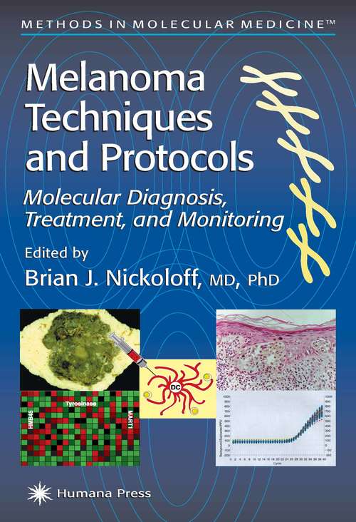 Book cover of Melanoma Techniques and Protocols