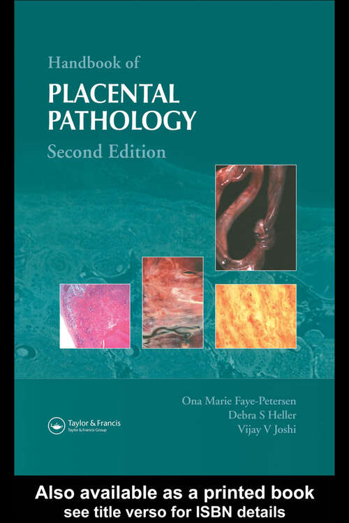 Book cover of Handbook of Placental Pathology