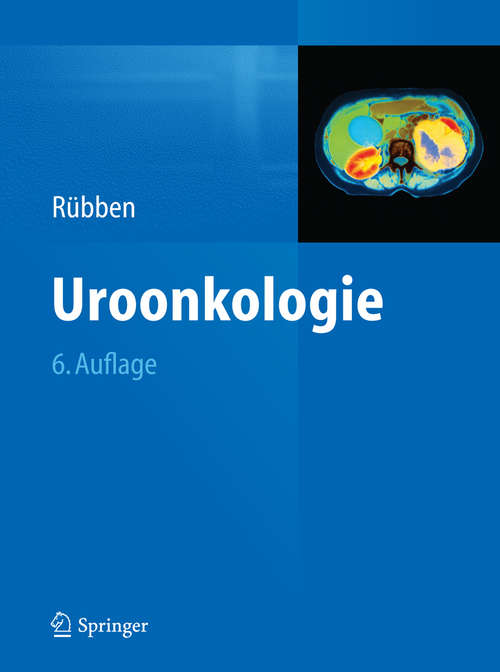 Book cover of Uroonkologie