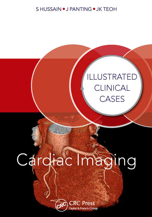 Book cover of Cardiac Imaging: Illustrated Clinical Cases (Illustrated Clinical Cases)