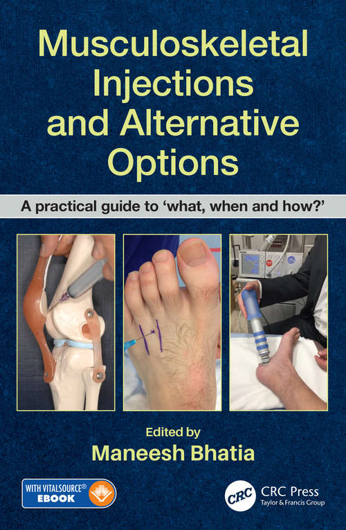 Book cover of Musculoskeletal Injections and Alternative Options: A practical guide to 'what, when and how?'