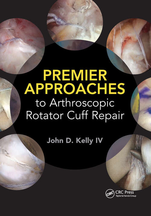 Book cover of Premier Approaches to Arthroscopic Rotator Cuff Repair