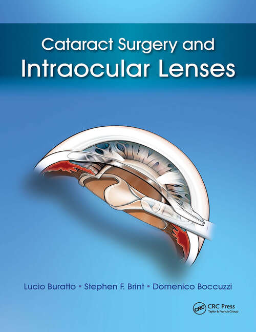 Book cover of Cataract Surgery and Intraocular Lenses