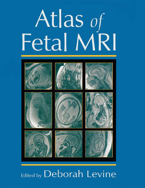 Book cover of Atlas of Fetal MRI