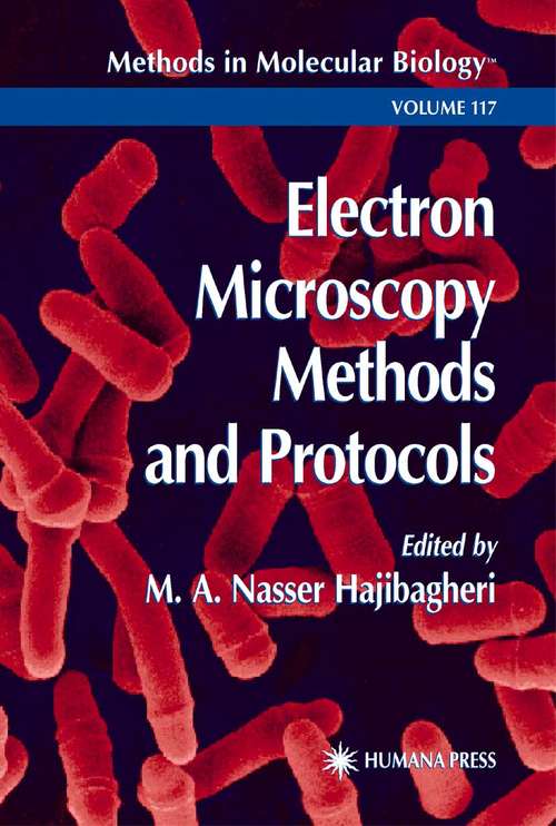 Book cover of Electron Microscopy Methods and Protocols