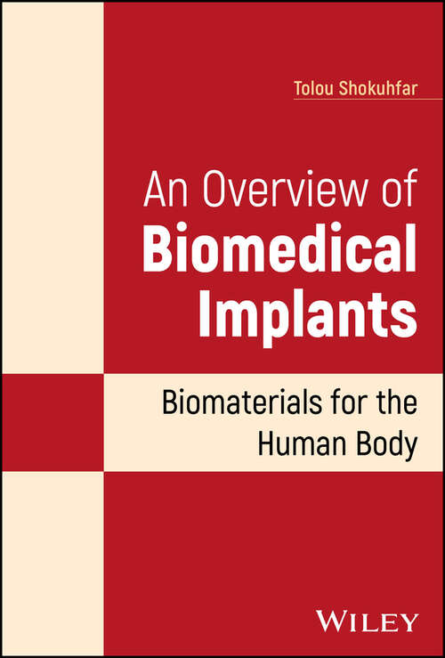 Book cover of An Overview of Biomedical Implants: Biomaterials for the Human Body